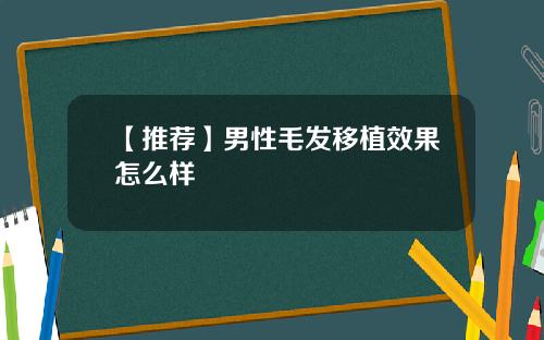 【推荐】男性毛发移植效果怎么样
