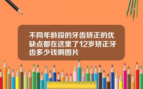不同年龄段的牙齿矫正的优缺点都在这里了12岁矫正牙齿多少钱啊图片