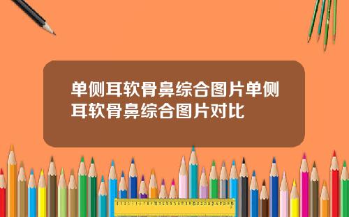 单侧耳软骨鼻综合图片单侧耳软骨鼻综合图片对比