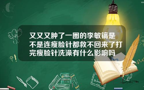 又又又肿了一圈的李敏镐是不是连瘦脸针都救不回来了打完瘦脸针洗澡有什么影响吗