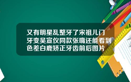 又有明星乱整牙了宋祖儿门牙变吴宣仪同款张嘴还能看到色差白鹿矫正牙齿前后图片