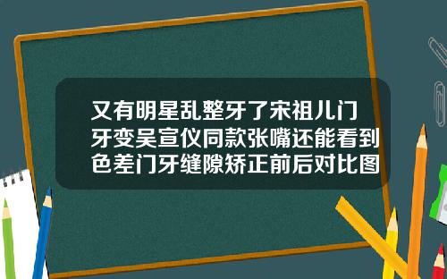 又有明星乱整牙了宋祖儿门牙变吴宣仪同款张嘴还能看到色差门牙缝隙矫正前后对比图