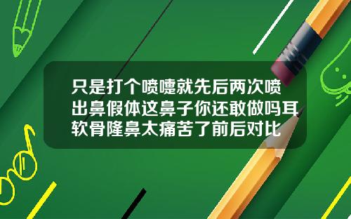 只是打个喷嚏就先后两次喷出鼻假体这鼻子你还敢做吗耳软骨隆鼻太痛苦了前后对比