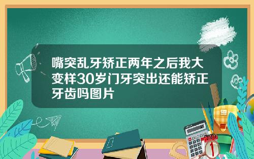 嘴突乱牙矫正两年之后我大变样30岁门牙突出还能矫正牙齿吗图片