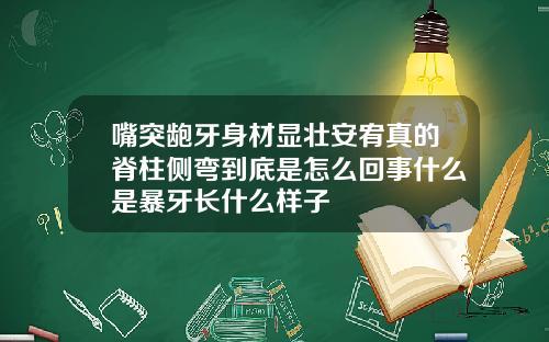 嘴突龅牙身材显壮安宥真的脊柱侧弯到底是怎么回事什么是暴牙长什么样子