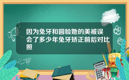 因为兔牙和圆脸她的美被误会了多少年兔牙矫正前后对比照