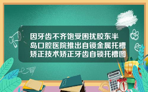 因牙齿不齐饱受困扰胶东半岛口腔医院推出自锁金属托槽矫正技术矫正牙齿自锁托槽图片