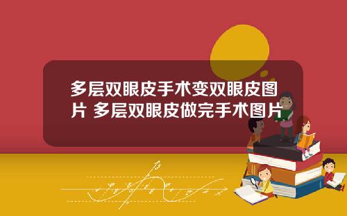 多层双眼皮手术变双眼皮图片 多层双眼皮做完手术图片