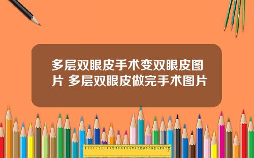 多层双眼皮手术变双眼皮图片 多层双眼皮做完手术图片