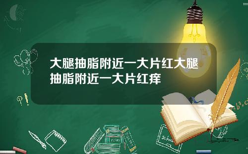 大腿抽脂附近一大片红大腿抽脂附近一大片红痒