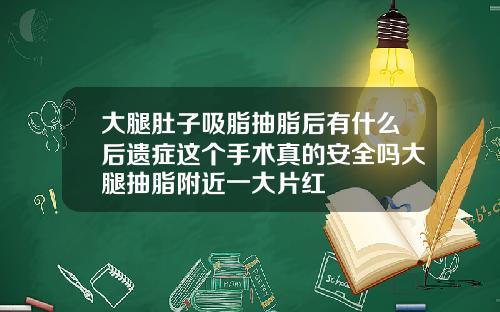 大腿肚子吸脂抽脂后有什么后遗症这个手术真的安全吗大腿抽脂附近一大片红