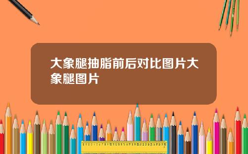 大象腿抽脂前后对比图片大象腿图片