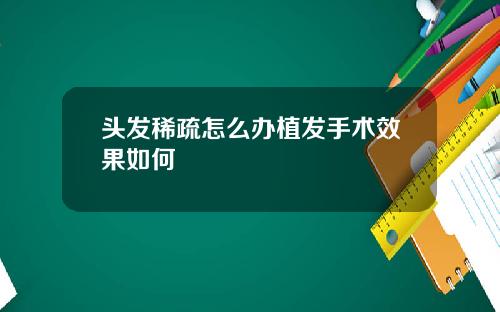头发稀疏怎么办植发手术效果如何