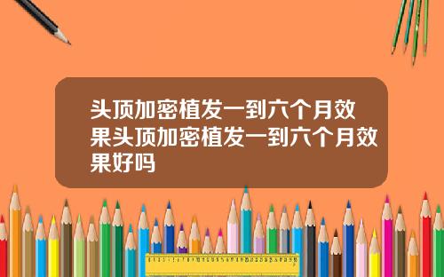 头顶加密植发一到六个月效果头顶加密植发一到六个月效果好吗