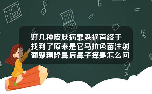好几种皮肤病罪魁祸首终于找到了原来是它马拉色菌注射葡聚糖隆鼻后鼻子痒是怎么回事呢