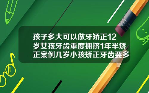 孩子多大可以做牙矫正12岁女孩牙齿重度拥挤1年半矫正案例几岁小孩矫正牙齿要多少