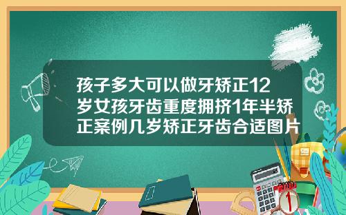孩子多大可以做牙矫正12岁女孩牙齿重度拥挤1年半矫正案例几岁矫正牙齿合适图片大全