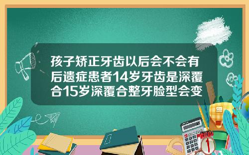 孩子矫正牙齿以后会不会有后遗症患者14岁牙齿是深覆合15岁深覆合整牙脸型会变吗