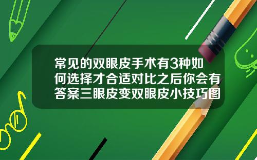 常见的双眼皮手术有3种如何选择才合适对比之后你会有答案三眼皮变双眼皮小技巧图片