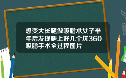 想变大长腿做吸脂术女子半年后发现腿上好几个坑360吸脂手术全过程图片