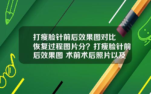 打瘦脸针前后效果图对比 恢复过程图片分?打瘦脸针前后效果图 术前术后照片以及真实案例