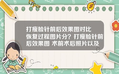 打瘦脸针前后效果图对比 恢复过程图片分?打瘦脸针前后效果图 术前术后照片以及真实案例