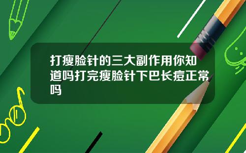 打瘦脸针的三大副作用你知道吗打完瘦脸针下巴长痘正常吗