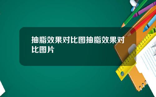 抽脂效果对比图抽脂效果对比图片