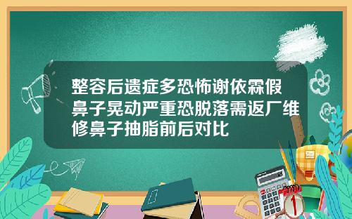 整容后遗症多恐怖谢依霖假鼻子晃动严重恐脱落需返厂维修鼻子抽脂前后对比