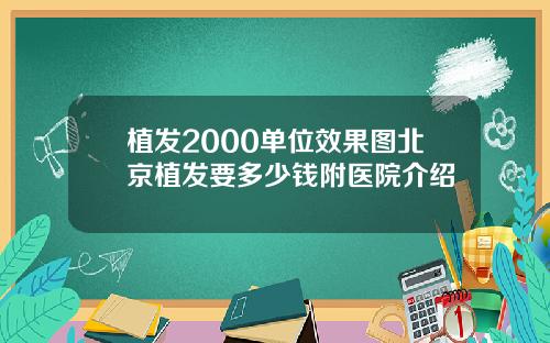 植发2000单位效果图北京植发要多少钱附医院介绍