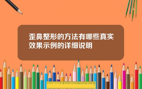 歪鼻整形的方法有哪些真实效果示例的详细说明