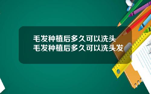 毛发种植后多久可以洗头 毛发种植后多久可以洗头发
