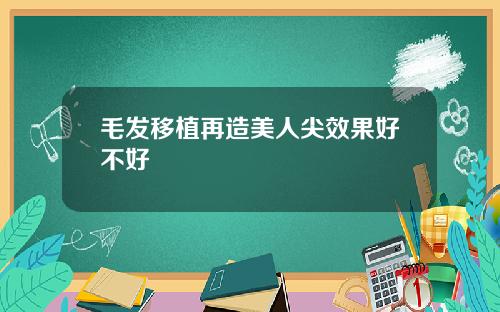 毛发移植再造美人尖效果好不好