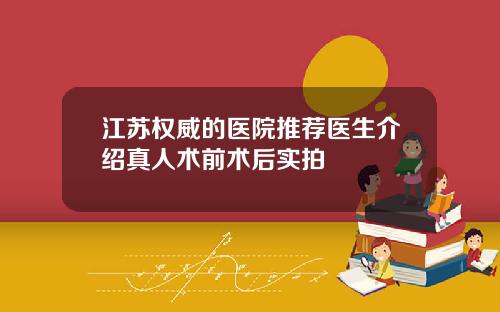 江苏权威的医院推荐医生介绍真人术前术后实拍