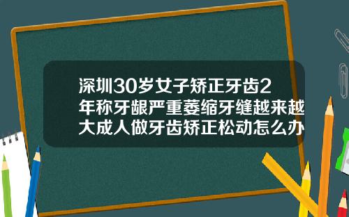 深圳30岁女子矫正牙齿2年称牙龈严重萎缩牙缝越来越大成人做牙齿矫正松动怎么办呢