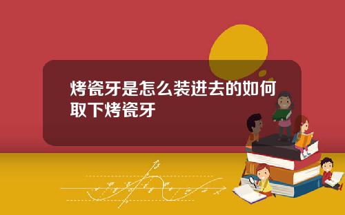 烤瓷牙是怎么装进去的如何取下烤瓷牙