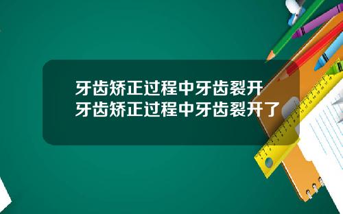 牙齿矫正过程中牙齿裂开 牙齿矫正过程中牙齿裂开了