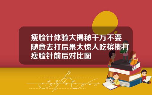 瘦脸针体验大揭秘千万不要随意去打后果太惊人吃槟榔打瘦脸针前后对比图