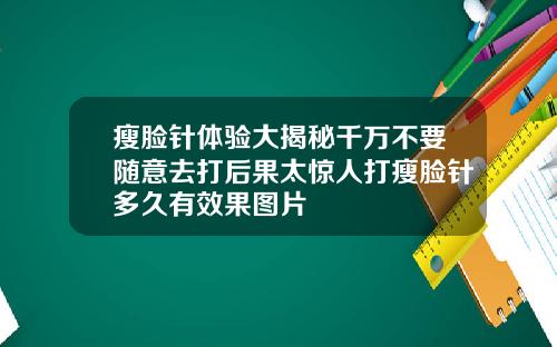 瘦脸针体验大揭秘千万不要随意去打后果太惊人打瘦脸针多久有效果图片