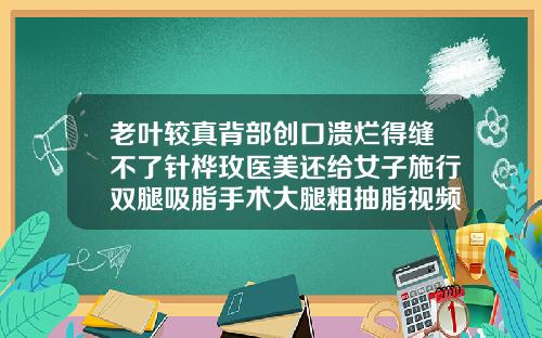 老叶较真背部创口溃烂得缝不了针桦玫医美还给女子施行双腿吸脂手术大腿粗抽脂视频