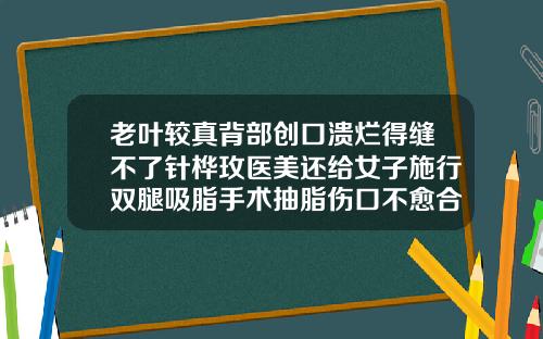老叶较真背部创口溃烂得缝不了针桦玫医美还给女子施行双腿吸脂手术抽脂伤口不愈合
