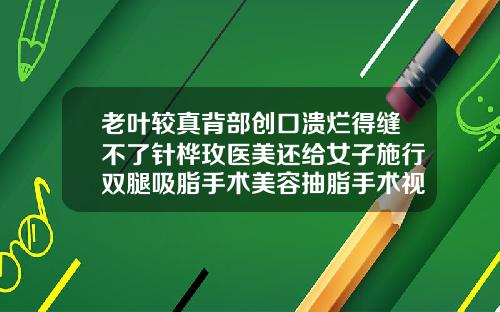 老叶较真背部创口溃烂得缝不了针桦玫医美还给女子施行双腿吸脂手术美容抽脂手术视频