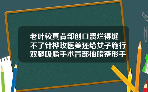 老叶较真背部创口溃烂得缝不了针桦玫医美还给女子施行双腿吸脂手术背部抽脂整形手术费用