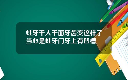 蛀牙千人千面牙齿变这样了当心是蛀牙门牙上有凹槽