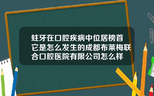 蛀牙在口腔疾病中位居榜首它是怎么发生的成都布莱梅联合口腔医院有限公司怎么样