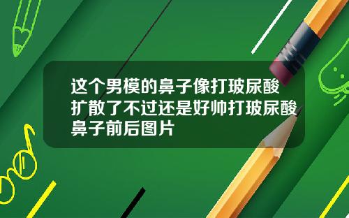 这个男模的鼻子像打玻尿酸扩散了不过还是好帅打玻尿酸鼻子前后图片