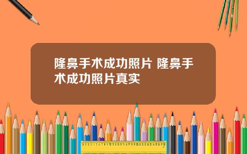 隆鼻手术成功照片 隆鼻手术成功照片真实