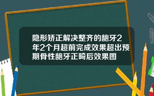 隐形矫正解决整齐的龅牙2年2个月超前完成效果超出预期骨性龅牙正畸后效果图