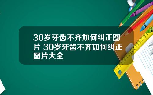 30岁牙齿不齐如何纠正图片 30岁牙齿不齐如何纠正图片大全