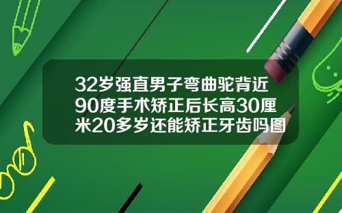 32岁强直男子弯曲驼背近90度手术矫正后长高30厘米20多岁还能矫正牙齿吗图片